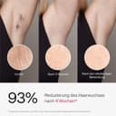 Thumbnail 1 de Ulike Air 3 Deluxe IPL-Haarentferner für Damen und Herren ⌚