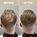 Thumbnail 5 de VOLLUCK Streuhaar 28 g Dunkelbraun — Haarverdichtung 🎯