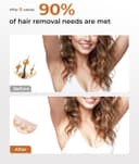 Thumbnail 5 de 21J Épilateur à lumière pulsée, 9 niveaux ⚡