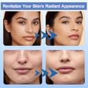 Thumbnail 5 de Dr.pen Ultima M8S stylo microneedling avec 9 cartouches ⚙️