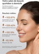 Thumbnail 3 de INIA Appareil de Lifting Visage Micro-courant & Luminothérapie — Soin Anti-Âge ⌚