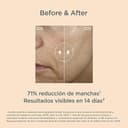 Thumbnail 8 de ISDIN Isdinceutics Melaclear 30 ml, sérum anti-taches 📷