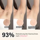 Thumbnail 2 de RWSRW IPL Épilateur lumière pulsée 0,2 s — 5 niveaux 🎀