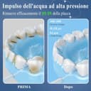 Thumbnail 1 de SURFOU Idropulsore dentale portatile, irrigatore orale da viaggio 🚿