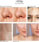 Thumbnail 4 de Dr.Ancient Jabón de Árbol de Té 140 g 🌿 Antibacteriano y Natural