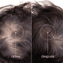 Thumbnail 1 de Klorane KeratinCaps Cápsulas para Cabello y Uñas 💊