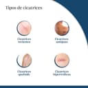 Thumbnail 2 de Trofolastin - Parche reductor cicatrices 👍 - 5x7.5 cm, 5 Unidades