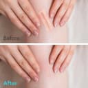 Thumbnail 5 de Hydrocolloid Roll 2in x 12ft wound dressing 🩹