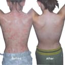 Thumbnail 2 de Salcura Bioskin Zeoderm Intensive Moisturiser 150ml 🧴