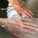 Thumbnail 4 de Salcura Bioskin Zeoderm Intensive Moisturiser 150ml 🧴