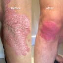 Thumbnail 6 de Salcura Bioskin Zeoderm Intensive Moisturiser 150ml 🧴