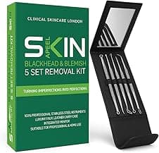 Skinapeel 5pc Blackhead and Blemish Extraction Kit 🛍️