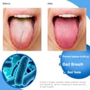 Thumbnail 1 de Stainless Steel Tongue Cleaner Metal with Case — Oral Care 🪥