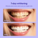Thumbnail 3 de Teeth Whitening Powder 1.7 oz 🪥