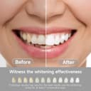 Thumbnail 1 de TeethBliss Teeth Whitening Strips 14 treatments 😊