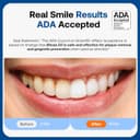 Thumbnail 2 de Bitvae ADA Accepted Electric Toothbrush 60-Day ⌚