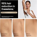 Thumbnail 10 de Braun Silk·Expert Pro 5 IPL5347 permanent hair reduction device 🪒