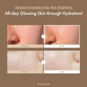 Thumbnail 1 de Dr.Ceuracle Kombucha Toner 150ml 📷