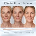 Thumbnail 3 de Fygrip XL Disposable Face Towels 50 pack 🧻