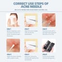 Thumbnail 3 de JPNK Blackhead Remover kit for acne extraction 🎯