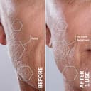 Thumbnail 4 de Michael Todd Sonicsmooth Pro+ Dermaplane with 16 blades ⌚