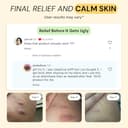 Thumbnail 3 de MyMagicHealer Flare Care Salve 📷