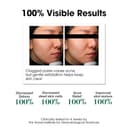 Thumbnail 3 de SOME BY MI AHA BHA PHA Toner with 2% Niacinamide ⚙️