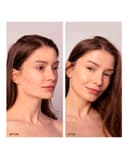 Thumbnail 3 de FOREO ESPADA™ 2 Plus dispositivo antiacné con luz LED 💆♀️