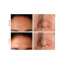 Thumbnail 4 de FOREO KIWI™ extractor de puntos negros con luz azul 💄