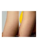 Thumbnail 5 de FOREO PEACH™ 2 go Dispositivo IPL para depilación permanentemente Lavender 📷