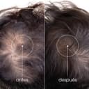 Thumbnail 1 de Klorane KeratinCaps 3x30 Cápsulas para Cabello y Uñas 💊