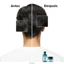 Thumbnail 2 de L’Oréal Professionnel Scalp Advanced champú antigrasa 500 ml 🧴