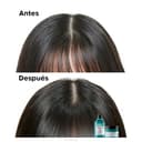 Thumbnail 5 de L’Oréal Professionnel Scalp Advanced champú antigrasa 500 ml 🧴