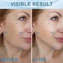 Thumbnail 4 de INTENSO Face Massager for Anti-Aging and Facial Care 🚿