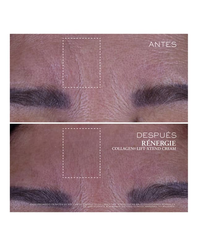 Detalle de Lancôme Rénergie Collage Lift-Xtend Cream 50 ml