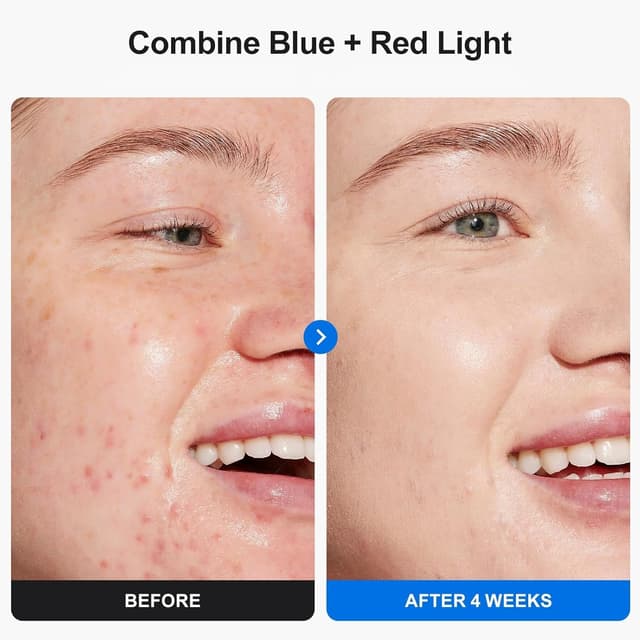 Detalle de Profey Maschera LED viso 7 colori