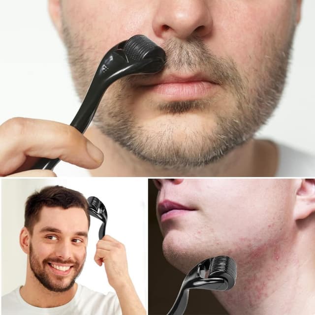 Detalle 2 de Zemolo 2er Derma-Roller Set (0,25 mm & 0,5 mm) mit 540 Micronadeln für Gesicht, Bart und Kopfhaut