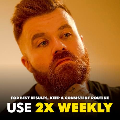 Thumbnail 4 de Beard Club Premium Derma Roller with 540 needles ⚙