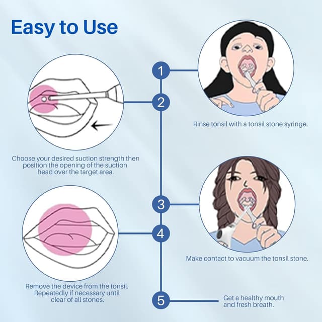 Detalle 2 de Vhipu Tonsillenstein Entferner Set, 6 Saugmodi