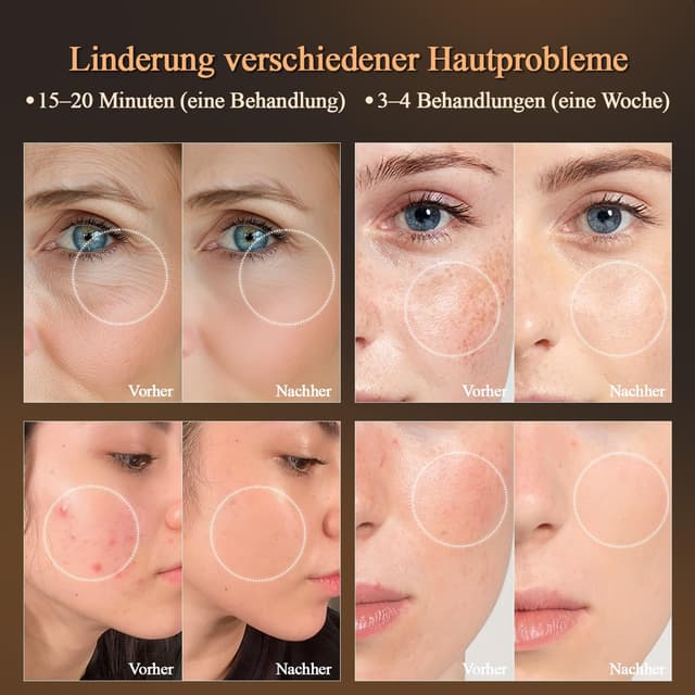 Detalle de MEGELIN LED Lichttherapie Gesichtsmaske mit 7 Modi und Infrarot-Licht