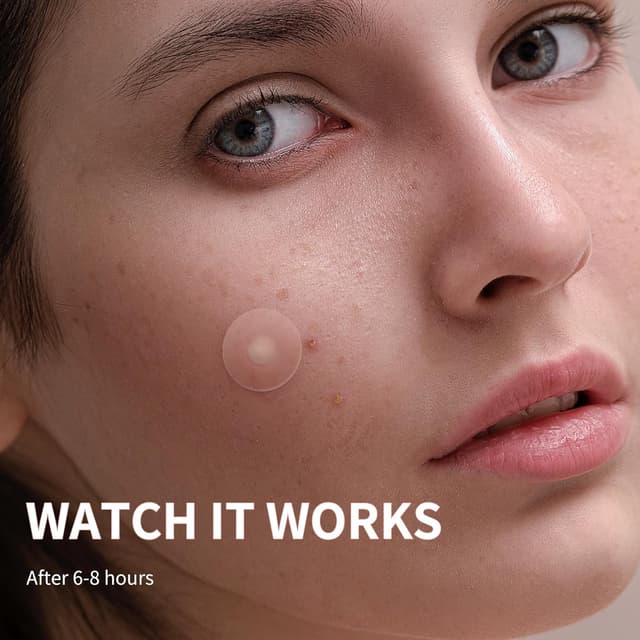 Detalle 2 de Daolyo Pimple Patches 300-count acne stickers