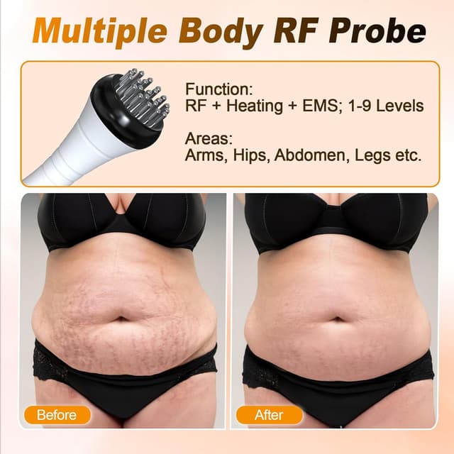 Detalle 2 de Qewher 3 in 1 radiofrequenza viso e corpo 40K: massaggiatore anticellulite con riscaldamento, EMS e luce rossa