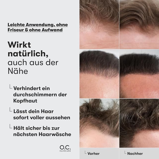 Detalle 2 de Ansatzpuder für Haarverdichtung 9 Farben