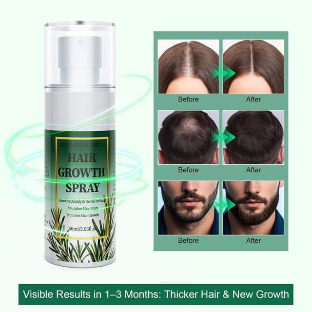 Detalle 2 de Aisisree Haarwachstums Serum Spray 60 ml