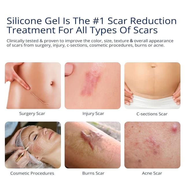 Detalle de 100% Silicone Scar Gel 2-Pack (2 x 1.06oz) for Surgical Scars, C-Section, Acne Marks, Keloids, Burns & Stretch Marks