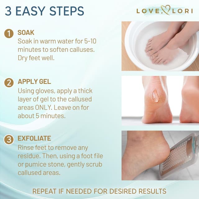 Thumbnail 3 de Callus Remover for Feet Extra Strength 6oz 🦶 (but must be one line with product category emoji).