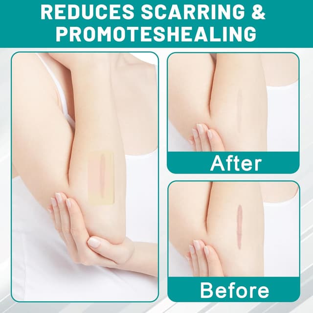 Thumbnail 5 de SLGCBL Hydrokolloid Pflaster 5 cm Rolle