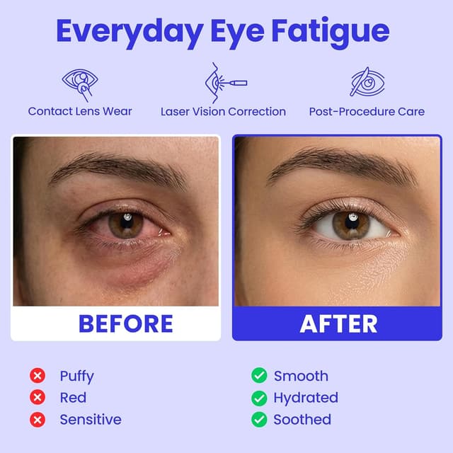 Thumbnail 2 de Self Heating Warm Compress Steam Eye Mask 15-pack