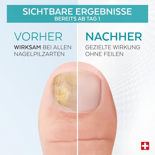 Thumbnail 2 de PODERM Nagelpilz-Behandlung revitalisierend