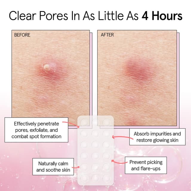 Thumbnail 2 de Grace & Stella Pore Strip Pimple Patches